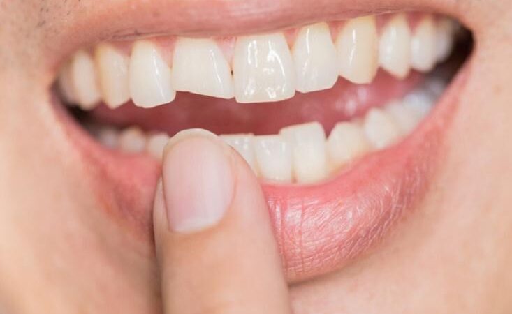 Therapeutic Options for Enhancing Smile Esthetics