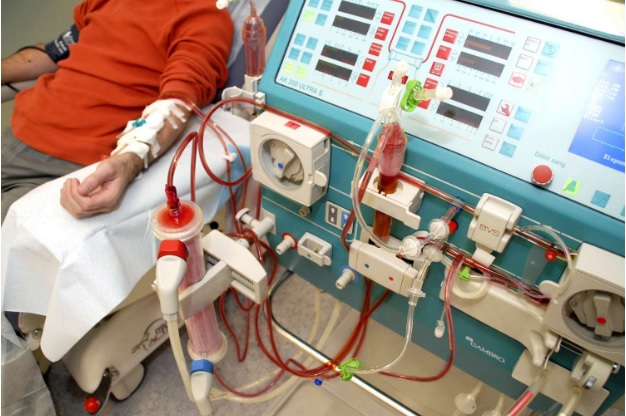 What Affects the Price of a Dialysis Machine in India?