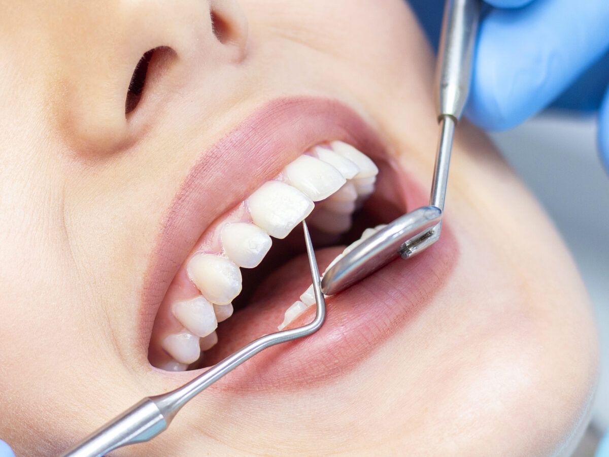 Common Dental Services Offered by Dentists in Abu Dhabi