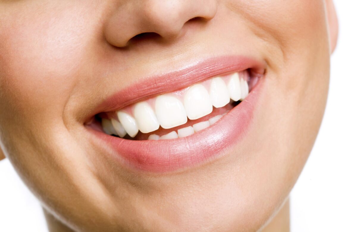 Safe and Effective Teeth Whitening Options Available in Singapore